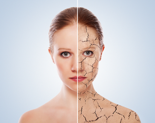 Get Rid Of That Dry Skin With These 6 Tips | Shutterstock