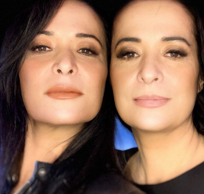 Didem y Sinem Balik | Instagram/@operatwins