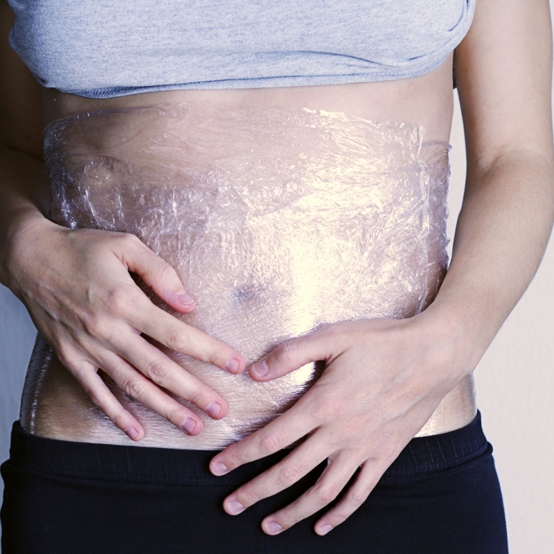 Full Marks for Stretch Marks | Getty Images Photo by luckyj1