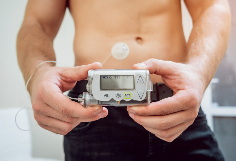 Insulin Pumps | Shutterstock