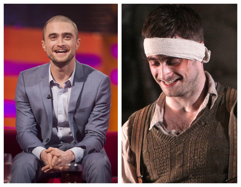 Daniel Radcliffe se convirtió en un lisiado para “The Cripple of Inishmaan” | Alamy Stock Photo by Matt Crossick/PA Images & WENN Rights Ltd