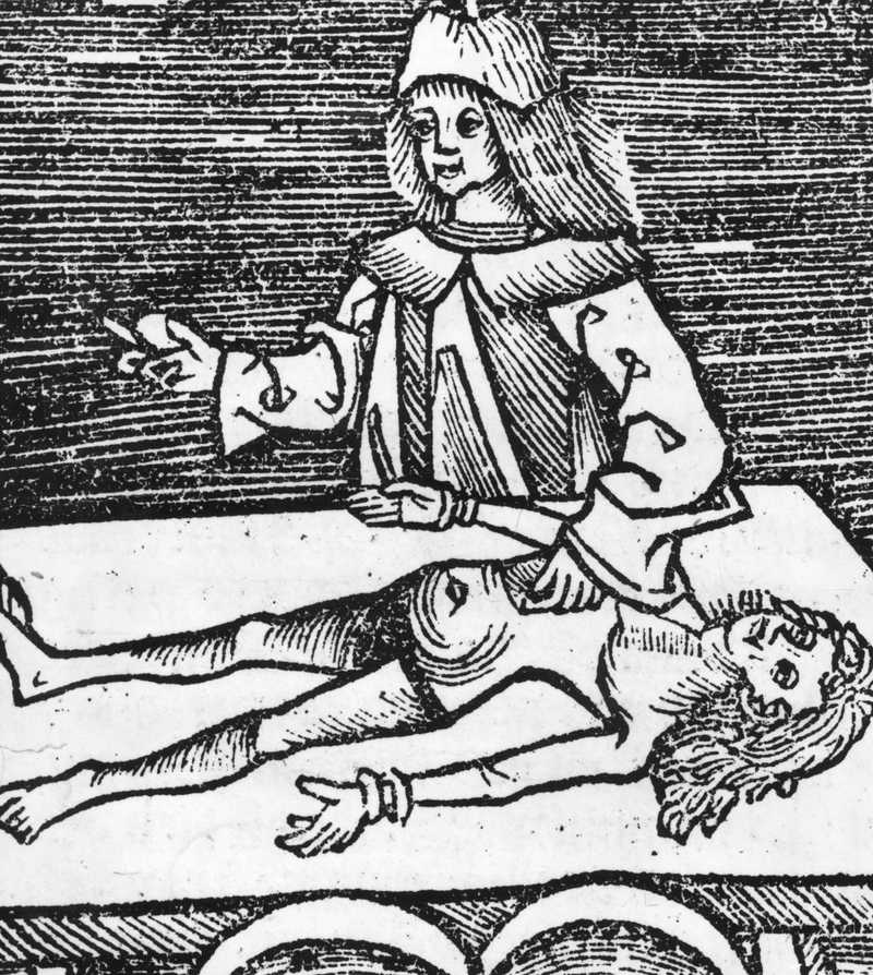 Cirurgia medieval era muitas vezes fatal | Getty Images Photo by Hulton Archive