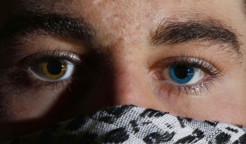 Olhos em Cores Diferentes | Getty Images Photo by Javier Garca Calleja/EyeEm