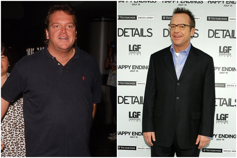 Tom Arnold – 34 kilos | Alamy Stock Photo