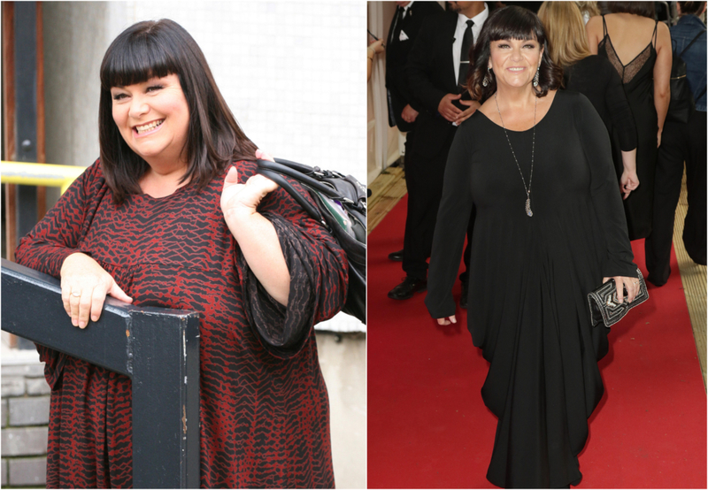 Dawn French – 98 libras | Alamy Stock Photo