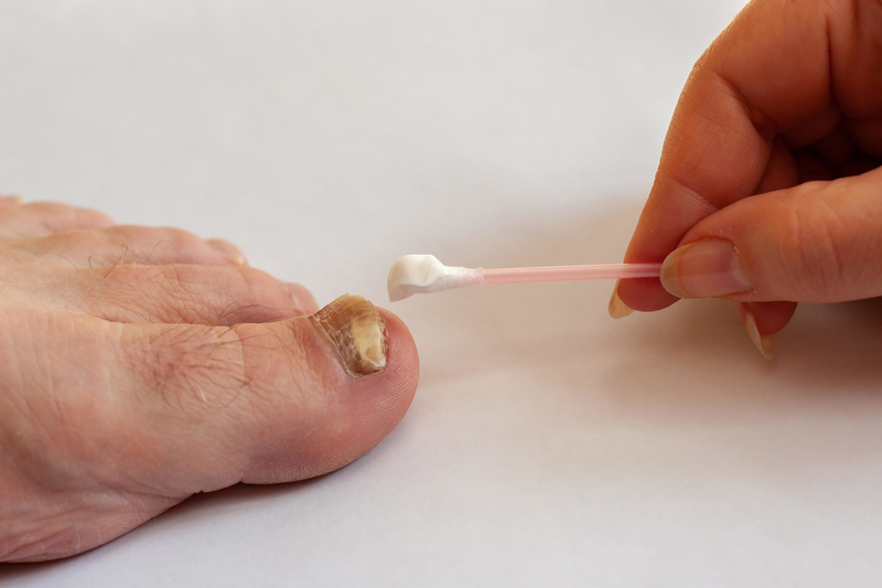 Fungal Toenail Foes | Alamy Stock Photo by Vladimir Kazakov