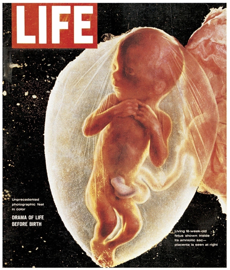 La primera foto de un feto vivo | Getty Images Photo by Photo 12/Universal Images Group